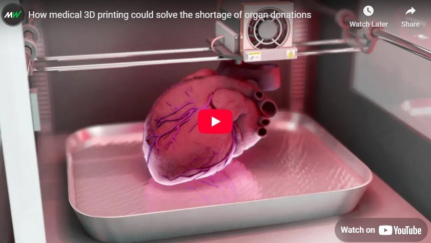 How Medical 3D Printing and Organ Donations: 