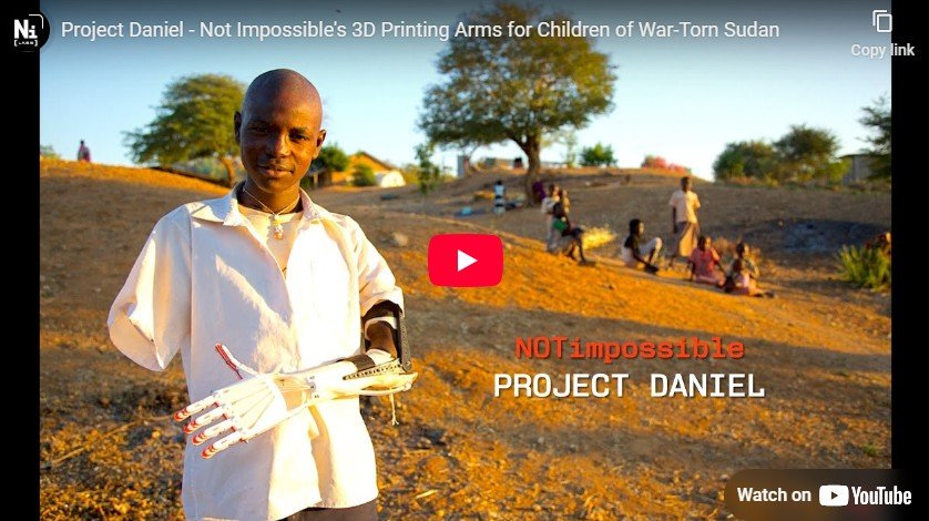 3D Printed Arms for Sudanese Children 